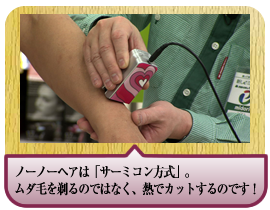 ノーノーヘアは「サーミコン方式」。ムダ毛を剃るのではなく、熱でカットするのです！