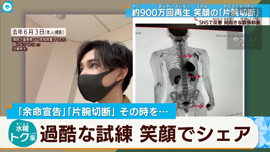 余命を告げられたら…明るく元気をくれる 1000万回再生・闘病動画の投稿者の生き方