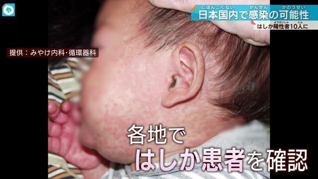 「はしか」市中感染か 大阪府が男性の発症を公表 感染力強いと注意呼びかけ